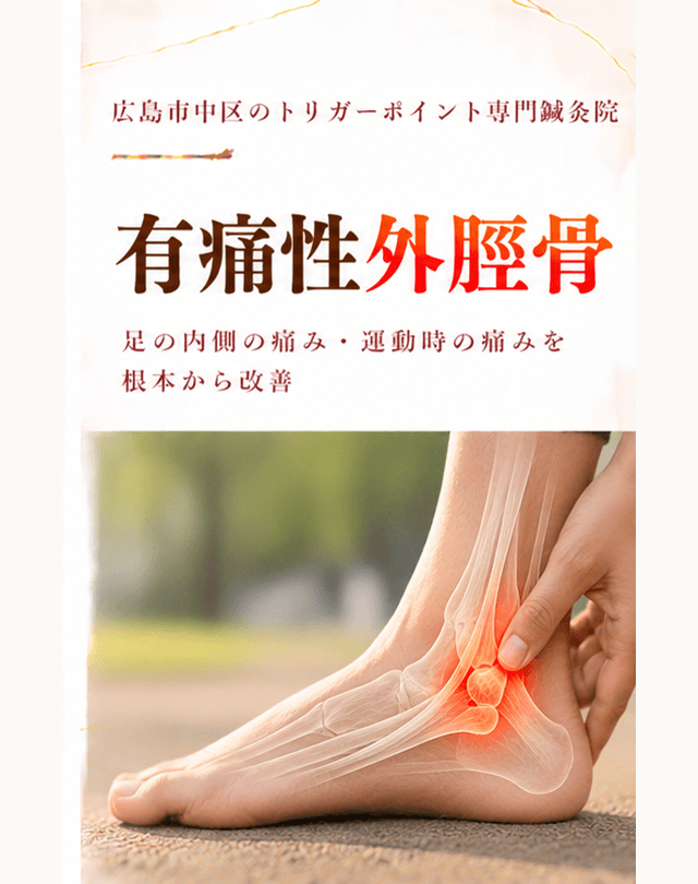 有痛性外脛骨トリガーポイント療法