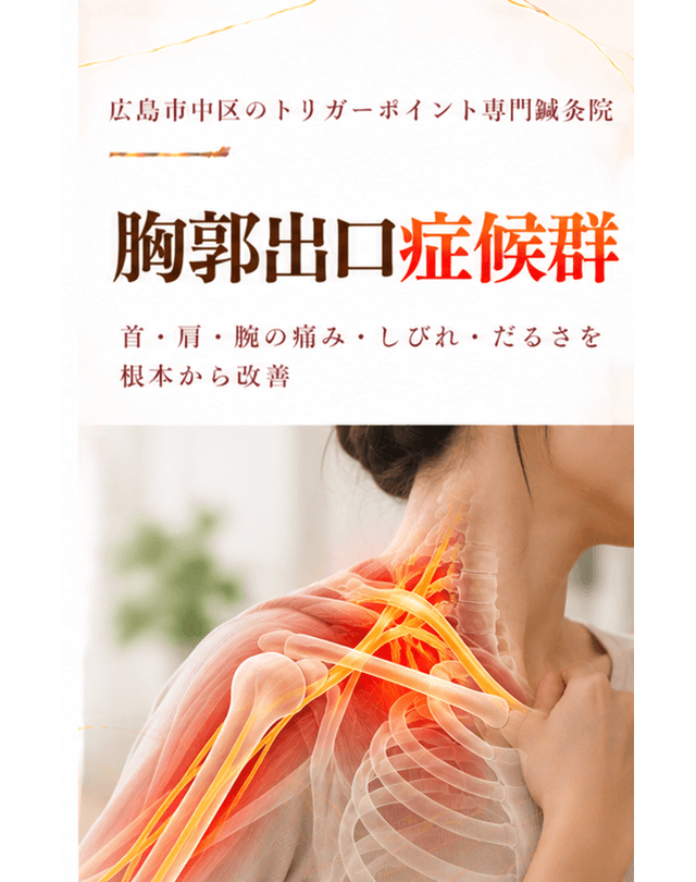 胸郭出口症候群トリガーポイント療法
