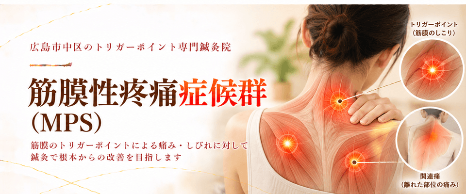 筋膜性疼痛症候群トリガーポイント療法