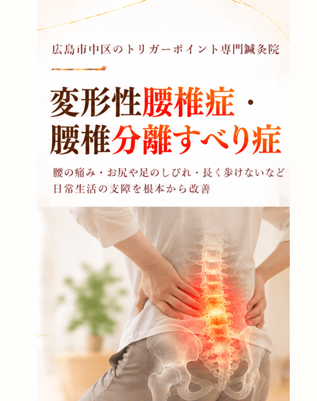 変形性腰椎症・腰椎分離すべり症トリガーポイント療法