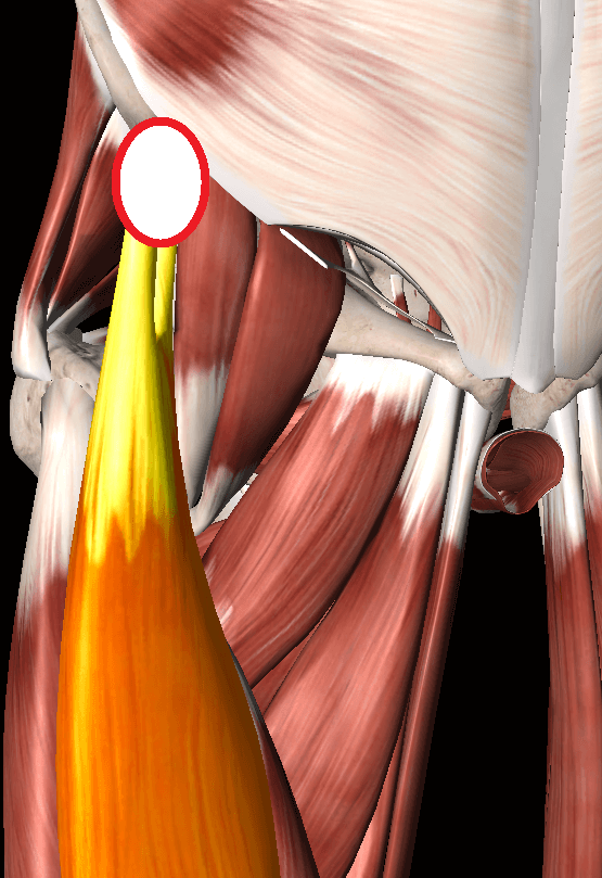 大腿直筋の痛み