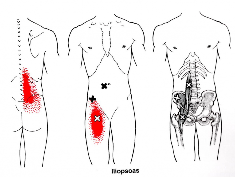 腰と股関節のトリガーポイント