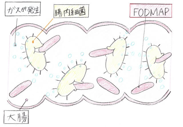 1.小腸で吸収されにくい糖質が過敏性腸症候群を悪化させる