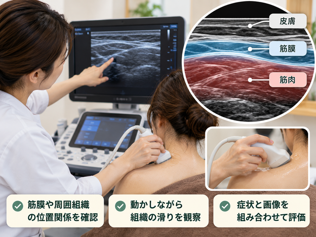 4.筋膜の癒着を調べるエコー観察
