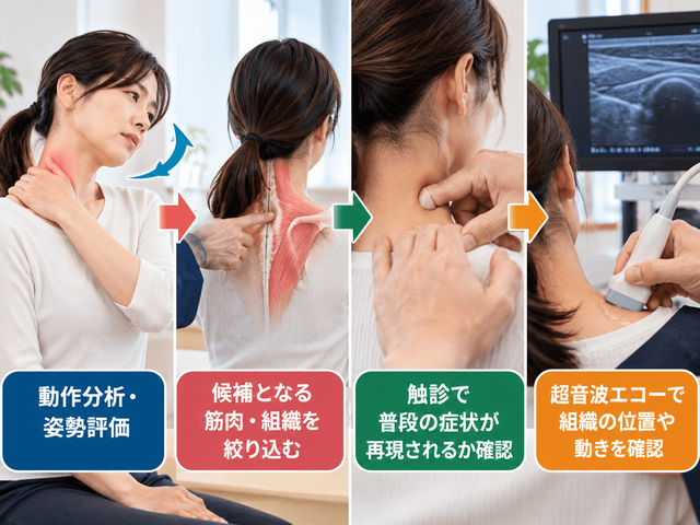 1.トリガーポイントの見つけ方は動作・圧痛・症状再現が重要