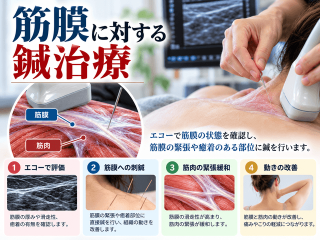 7.筋膜に対する鍼治療