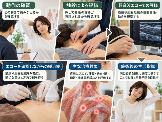 6.なかいし鍼灸院の筋膜癒着に対する評価と鍼治療