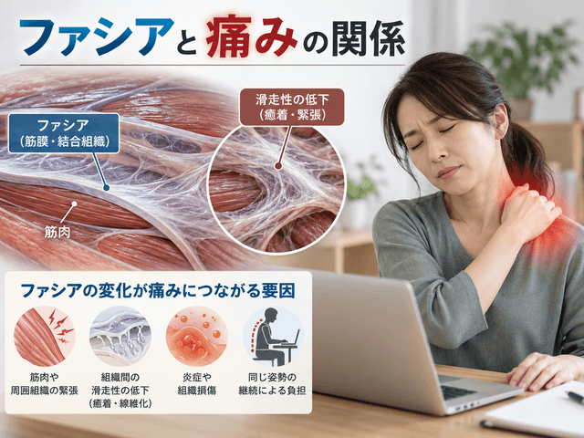 3.ファシアと痛みの関係