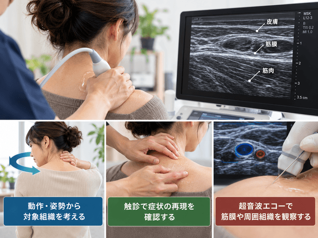 5.ファシアの状態を調べる方法
