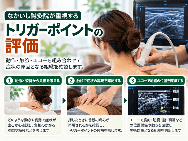 5.なかいし鍼灸院が重視するトリガーポイントの評価