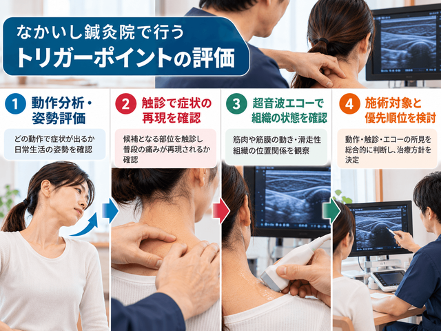 6.なかいし鍼灸院で行うトリガーポイントの評価